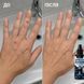 Спрей від бородавок CryoCare, 150 мл CRYOCARE-150 фото 4
