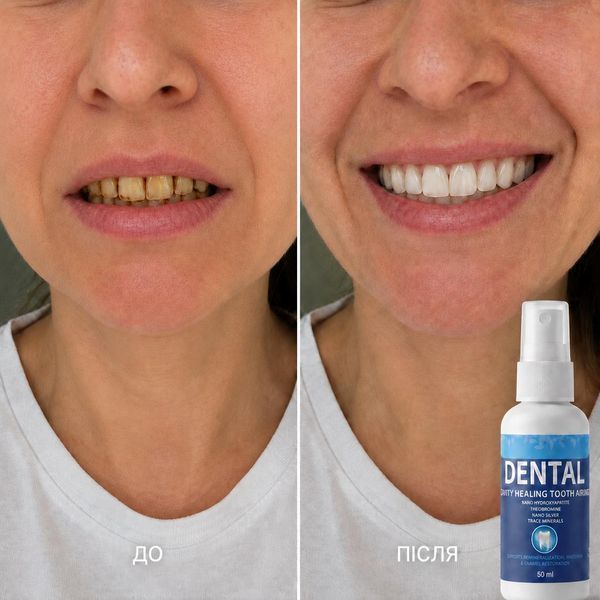 Спрей для зубів DENTAL, 50 мл DENTAL-50 фото
