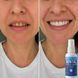 Спрей для зубів DENTAL, 50 мл DENTAL-50 фото 4