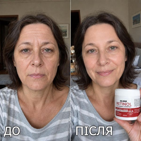Крем проти зморшок OUHOE Retinol Collagen Complex, 150 мл OUHOE-RETINOL-150 фото